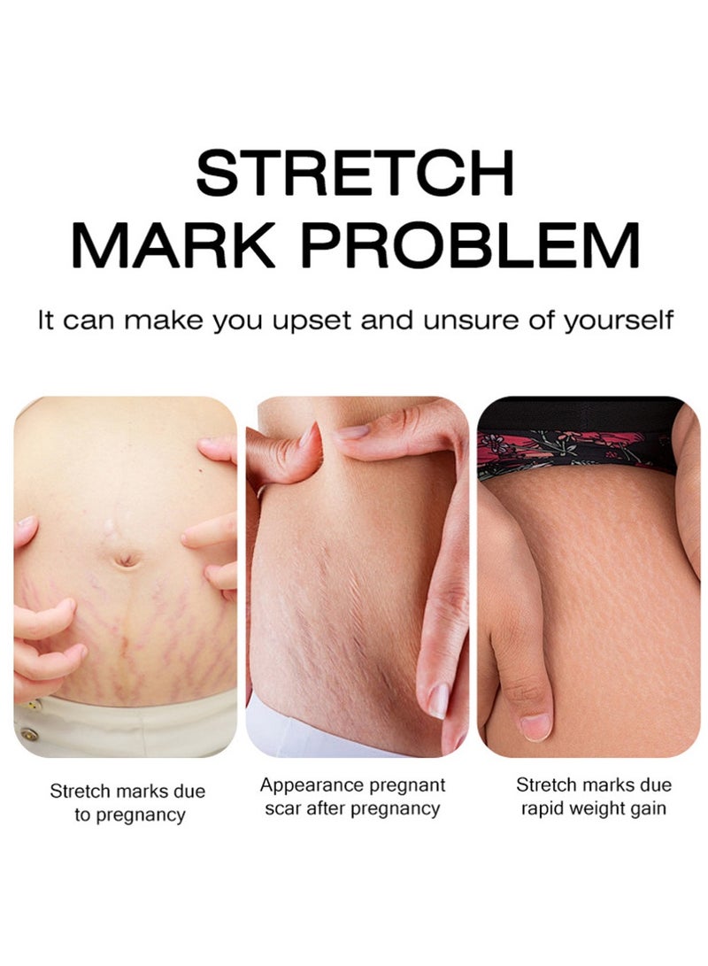 MOIKA Stretchmarks Cream Maternity Skin Treatment Pregnancy Scars Repair, Can Promote Cell Regeneration, Repair Necrotic Cells and Enhance Skin Elasticity, Designed For Mother's Stretch Marks - Image 2